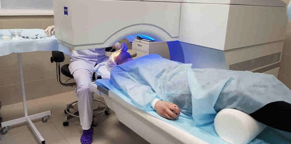 Лечение астигматизма в Москве отзывы