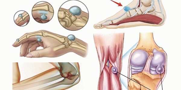 Операции на сухожилиях