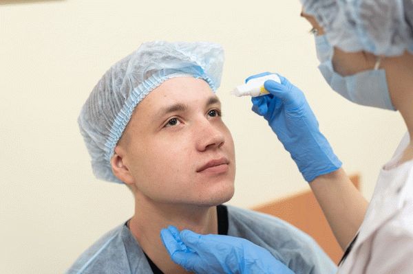 подготовка пациента к лазерной коррекции зрения