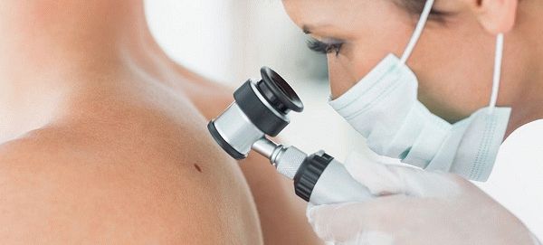 Виды псориаза