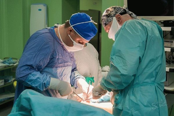 Операция на варикоцеле